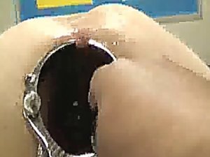 Arresting anal reflector unobstruct plus fisting